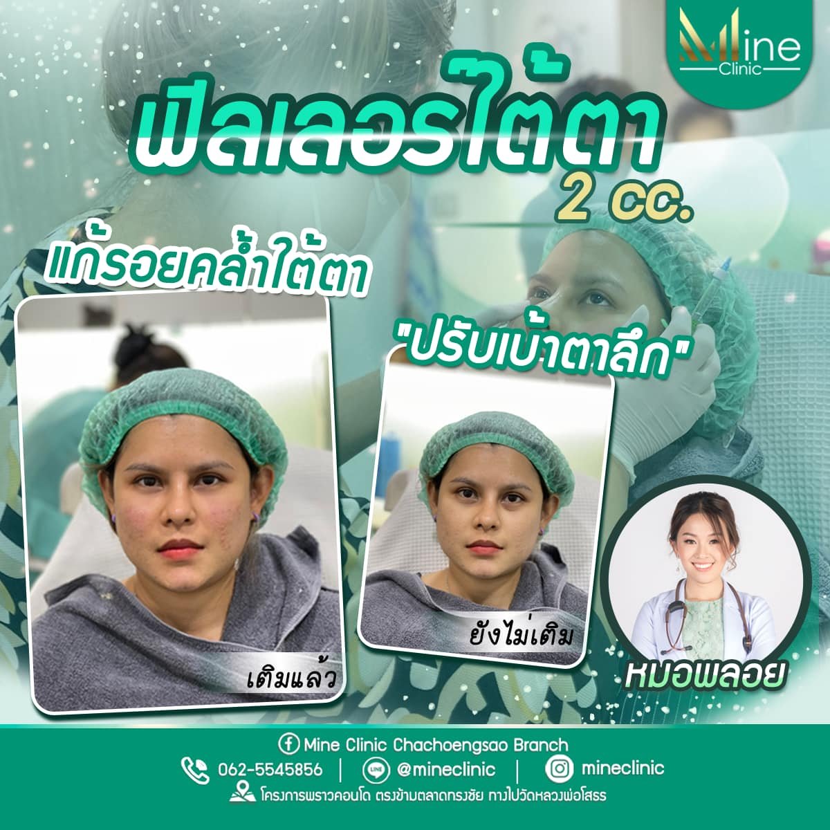 Review Case 4