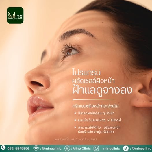 โปรแกรม ผลัดเซลล์ผิวหน้า ฝ้าแลดูจางลง
